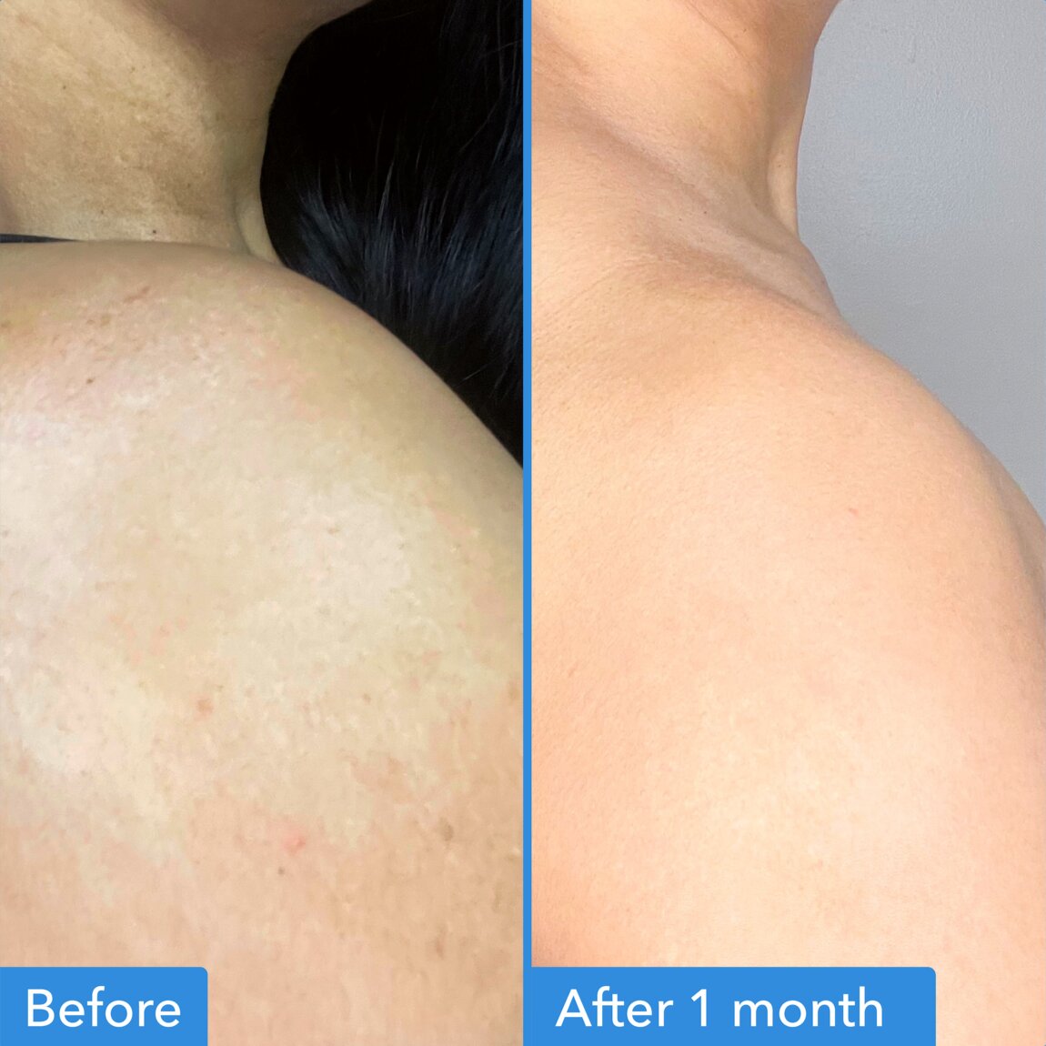 discoloration-correcting-body-treatment-k8 zb_p.jpg